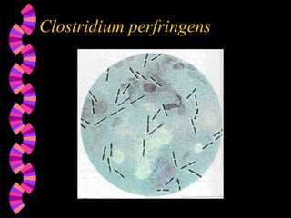 Clostridium perfringens
 