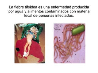 La fiebre tifoidea es una enfermedad producida por agua y alimentos contaminados con materia fecal de personas infectadas. 