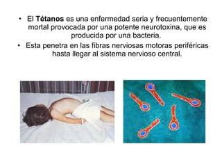 El  Tétanos  es una enfermedad seria y frecuentemente mortal provocada por una potente neurotoxina, que es producida por una bacteria.  Esta penetra en las fibras nerviosas motoras periféricas hasta llegar al sistema nervioso central. 