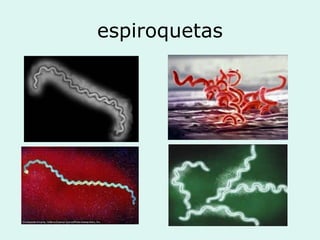 espiroquetas