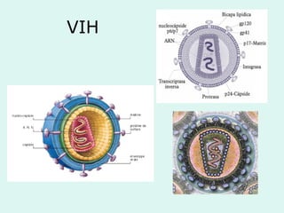VIH