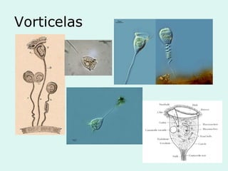 Vorticelas