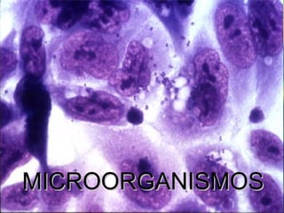 MICROORGANISMOSMICROORGANISMOS
 