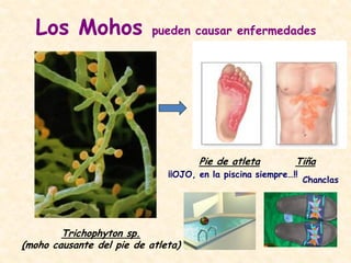 Los Mohos pueden causar enfermedades
Trichophyton sp.
(moho causante del pie de atleta)
Pie de atleta Tiña
¡¡OJO, en la piscina siempre…!!
Chanclas
 