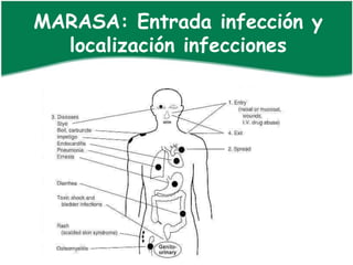 MARASA: Entrada infección y
  localización infecciones
 