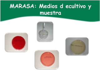 MARASA: Medios d ecultivo y
        muestra
 