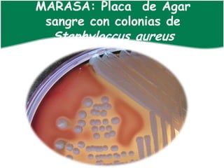 MARASA: Placa de Agar
 sangre con colonias de
  Staphyloccus aureus
 