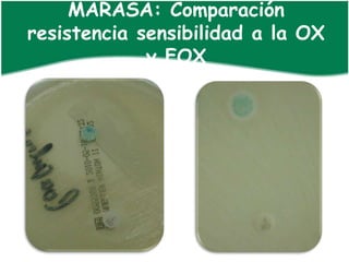 MARASA: Comparación
resistencia sensibilidad a la OX
             y FOX
 