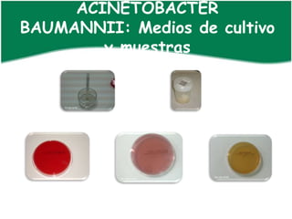 ACINETOBACTER
BAUMANNII: Medios de cultivo
        y muestras
 