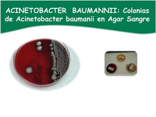 ACINETOBACTER BAUMANNII: Colonias
de Acinetobacter baumanii en Agar Sangre
 