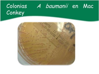 Colonias   A baumanii en Mac
Conkey
 