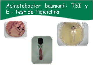 Acinetobacter baumanii: TSI y
E – Tesr de Tigiciclina
 