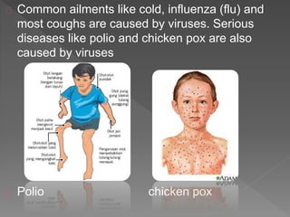Common ailments like cold, influenza (flu) and
most coughs are caused by viruses. Serious
diseases like polio and chicken pox are also
caused by viruses
Polio chicken pox
 