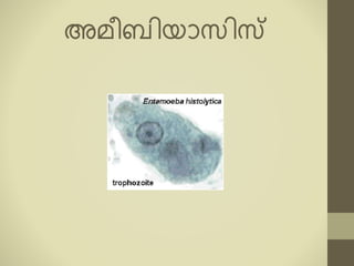 അൈീബിയോസിസ
 