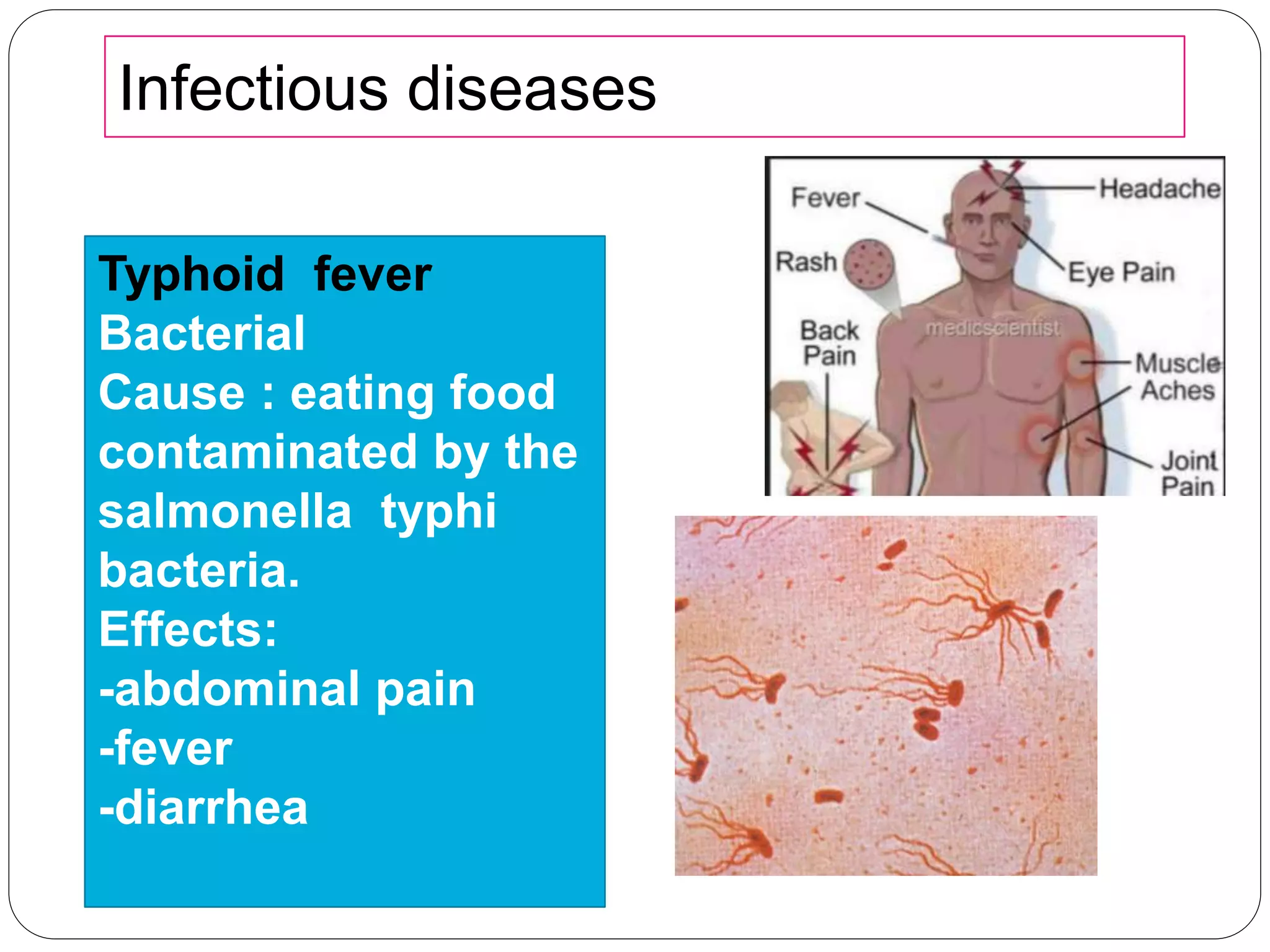 Infectious diseases
Typhoid fever
Bacterial
Cause : eating food
contaminated by the
salmonella typhi
bacteria.
Effects:
-abdominal pain
-fever
-diarrhea
 