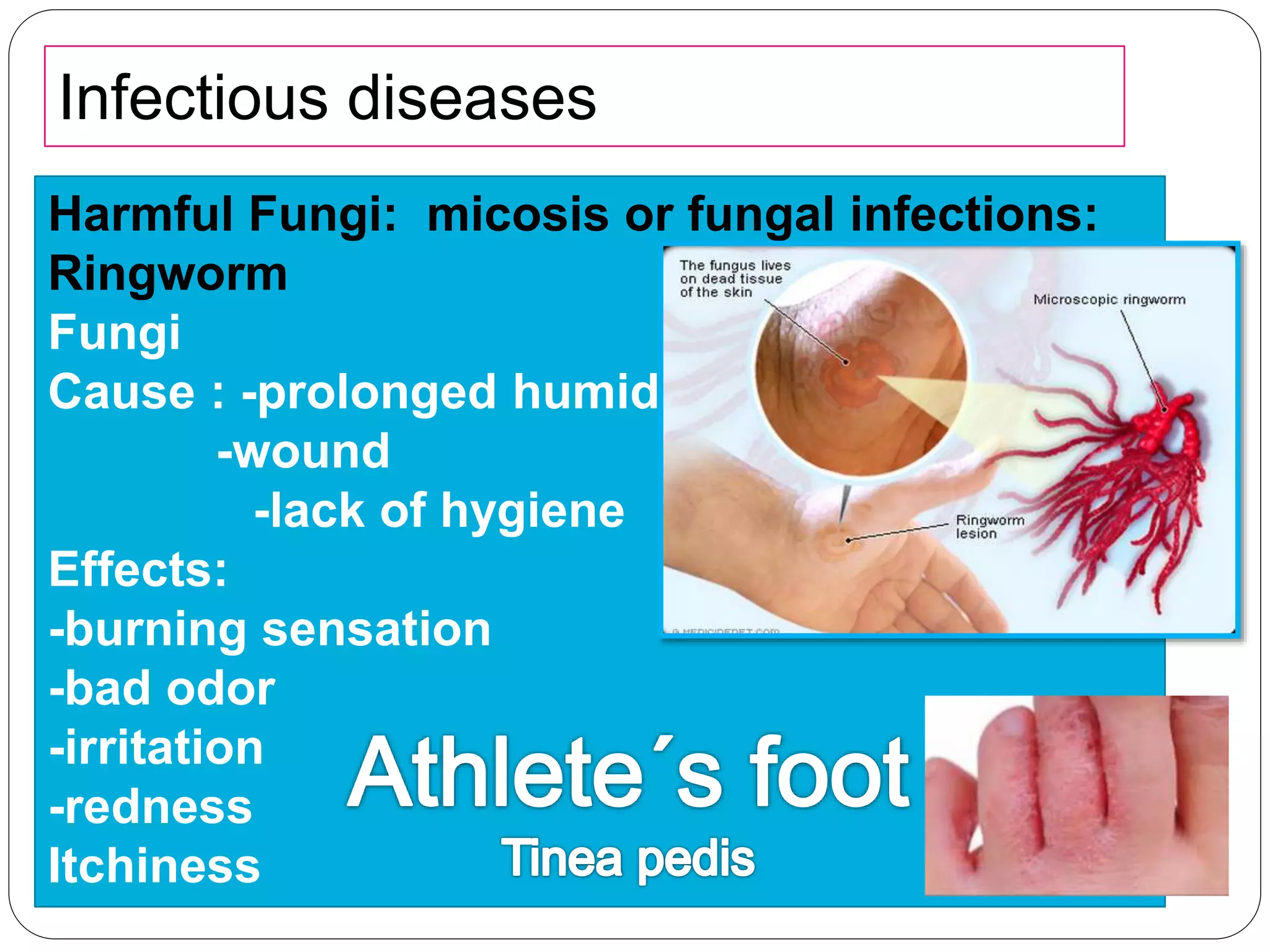 Infectious diseases
Harmful Fungi: micosis or fungal infections:
Ringworm
Fungi
Cause : -prolonged humidity
-wound
-lack of hygiene
Effects:
-burning sensation
-bad odor
-irritation
-redness
Itchiness
 