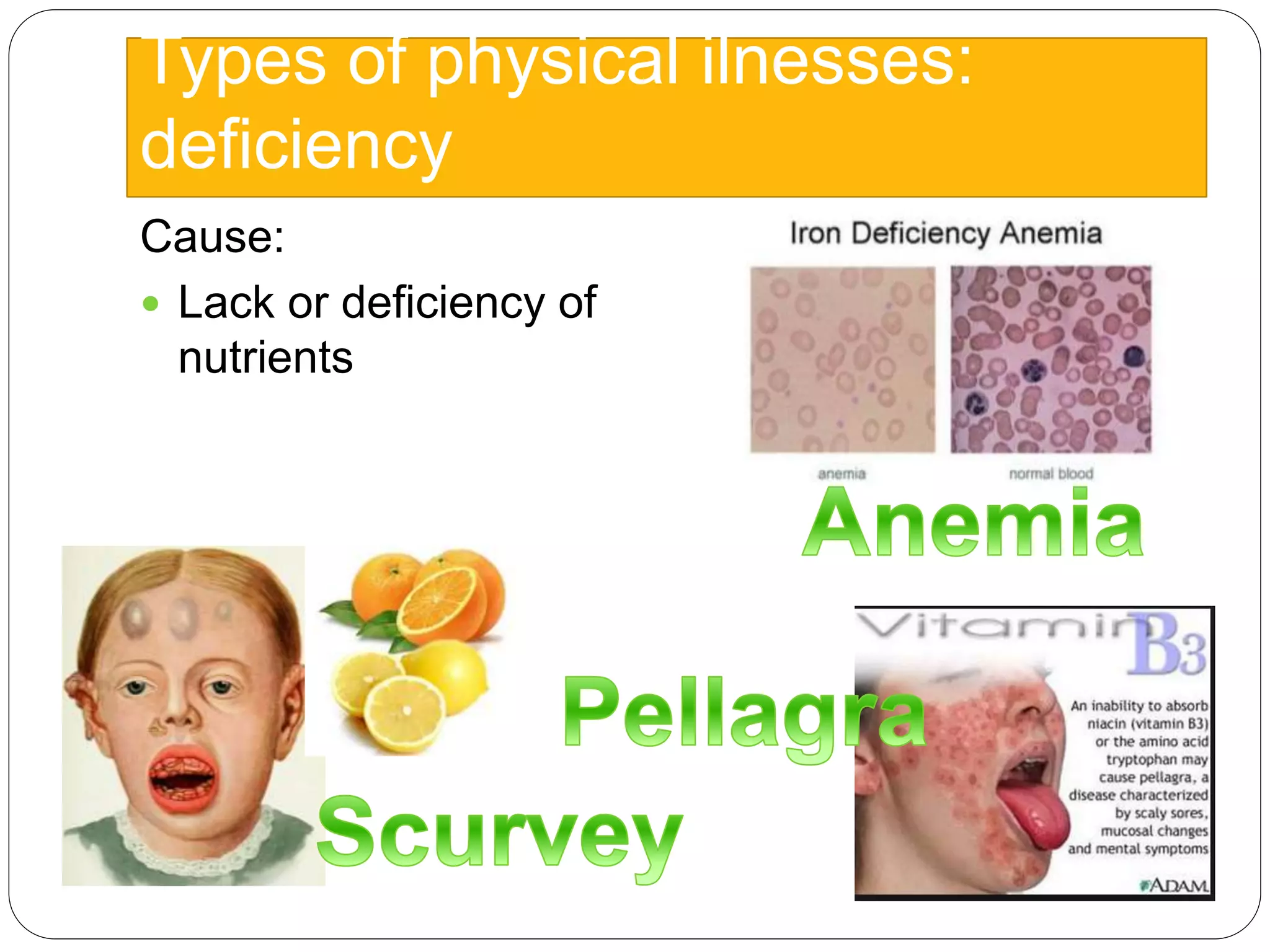 Types of physical ilnesses:
deficiency
Cause:
 Lack or deficiency of
nutrients
 