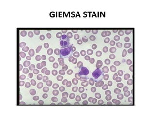 GIEMSA STAIN
 