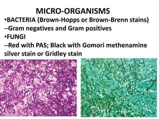 MICRO-ORGANISMS
•BACTERIA (Brown-Hopps or Brown-Brenn stains)
–Gram negatives and Gram positives
•FUNGI
–Red with PAS; Black with Gomori methenamine
silver stain or Gridley stain
 
