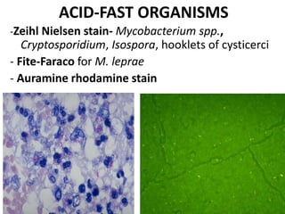 ACID-FAST ORGANISMS
-Zeihl Nielsen stain- Mycobacterium spp.,
Cryptosporidium, Isospora, hooklets of cysticerci
- Fite-Faraco for M. leprae
- Auramine rhodamine stain
 