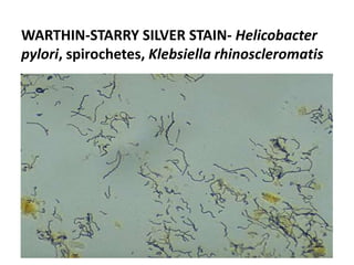 WARTHIN-STARRY SILVER STAIN- Helicobacter
pylori, spirochetes, Klebsiella rhinoscleromatis
 