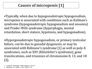 micropenis-in-children-evaluation-and-management-pdf