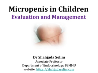 Micropenis in Children
Evaluation and Management
Dr Shahjada Selim
Associate Professor
Department of Endocrinology, BSMMU
website: https://shahjadaselim.com
 