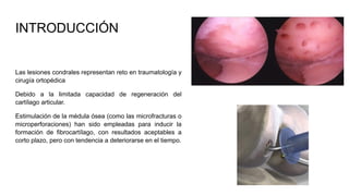 microperforaciones, nanoperforaciones y matriz de cartilago artificial ...