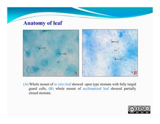 Anatomy of leaf

A

B

(A) Whole mount of in vitro leaf showed open type stomata with fully turgid
guard cells, (B) whole mount of acclimatized leaf showed partially
closed stomata.

 