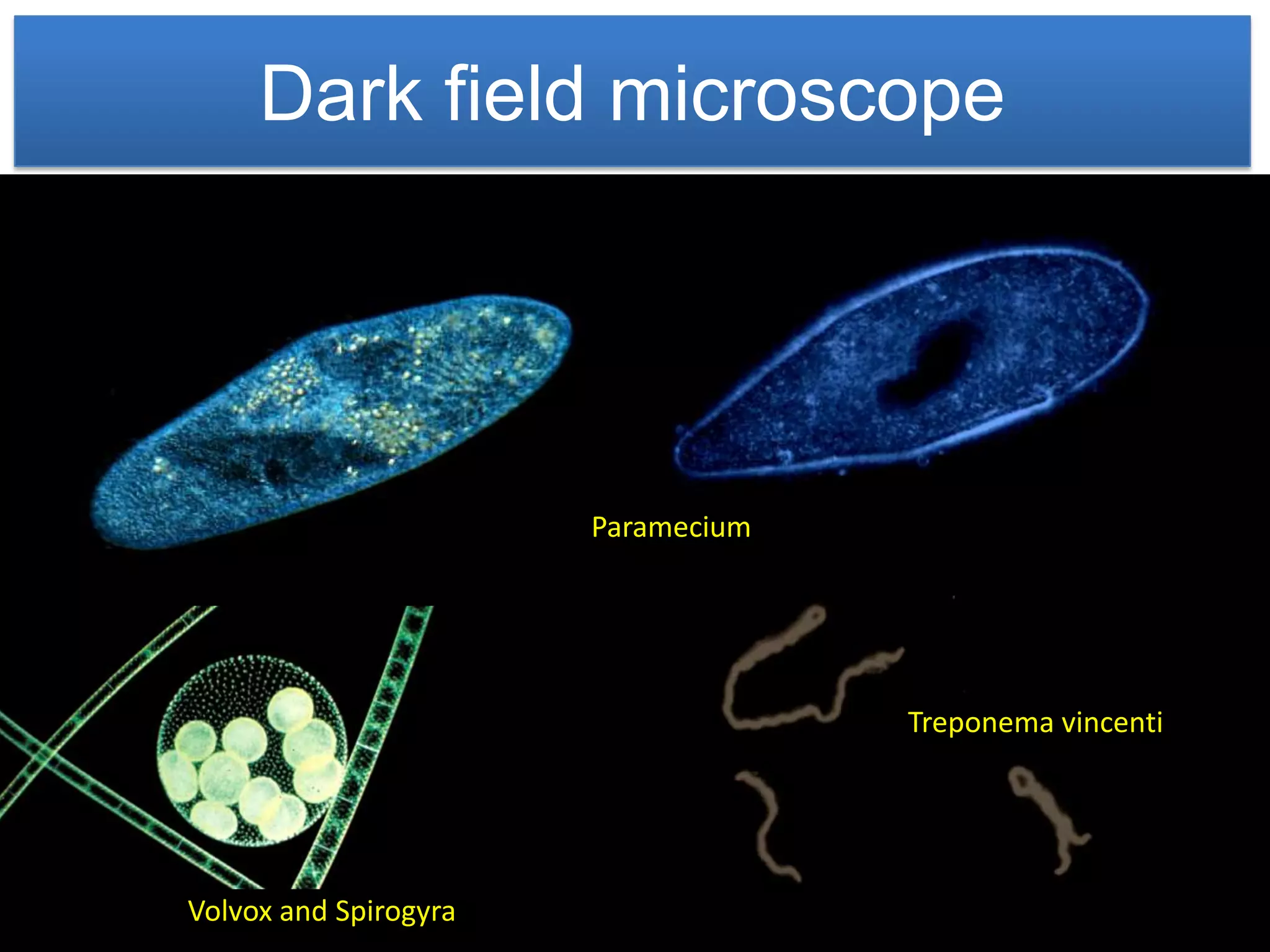 Dark field microscope




                       Paramecium




                                    Treponema vincenti




Volvox and Spirogyra
 