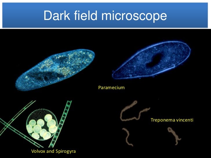 dark field microscopy