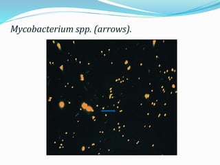 Mycobacterium spp. (arrows).
 