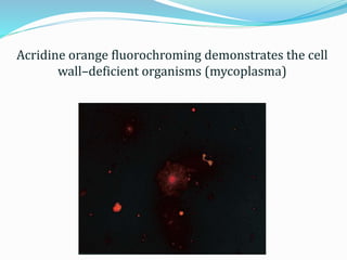 Acridine orange fluorochroming demonstrates the cell
wall–deficient organisms (mycoplasma)
 