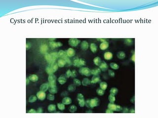 Cysts of P. jiroveci stained with calcofluor white
 