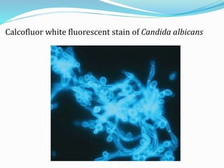 Calcofluor white fluorescent stain of Candida albicans
 