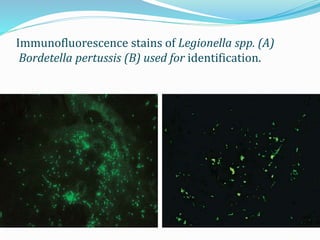 Immunofluorescence stains of Legionella spp. (A)
Bordetella pertussis (B) used for identification.
 
