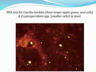 DFA test for Giardia lamblia (three larger apple-green, oval cells)
& Cryptosporidium spp. (smaller cells) in stool.
 