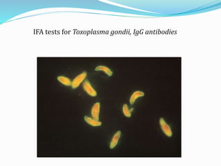 IFA tests for Toxoplasma gondii, IgG antibodies
 