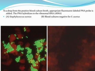 To a drop from the positive blood culture broth, appropriate fluorescent-labeled PNA probe is
added. The PNA hybridizes to the ribosomal RNA (rRNA)
 (A) Staphylococcus aureus (B) Blood cultures negative for S. aureus
 