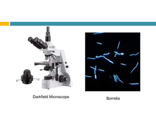 BorreliaDarkﬁeld Microscope
 