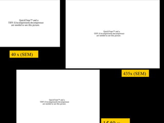 QuickTime™ and a
TIFF (Uncompressed) decompressor
   are needed to see this picture.

                                                                              QuickTime™ and a
                                                                   TIFF (Uncompressed) decompressor
                                                                      are needed to see this picture.




  40 x (SEM)



                                                                                                   435x (SEM)




                                         QuickTime™ and a
                              TIFF (Uncompressed) decompressor
                                 are needed to see this picture.
 