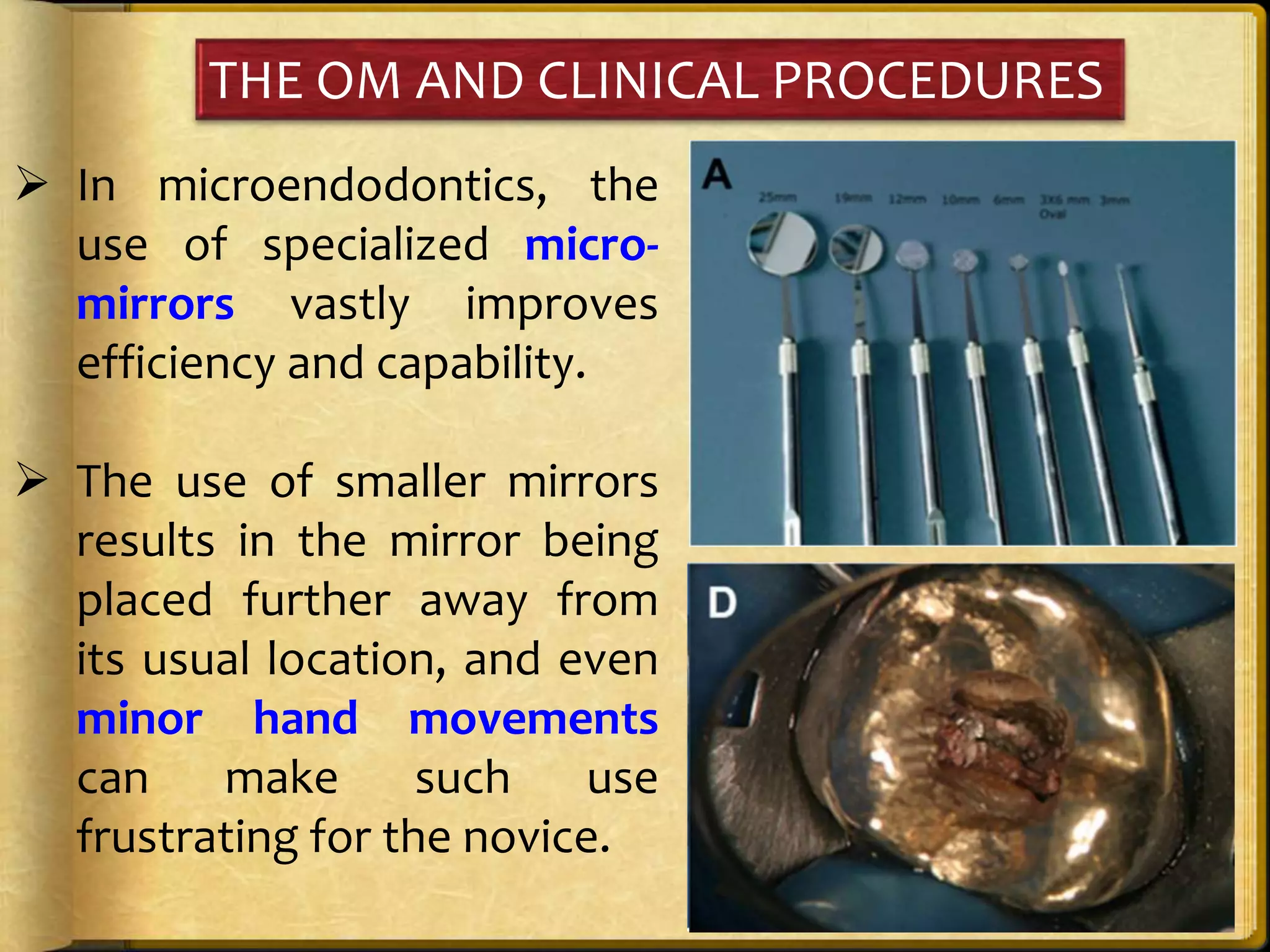 THE OM AND CLINICAL PROCEDURES
 In microendodontics, the
use of specialized micro-
mirrors vastly improves
efficiency and capability.
 The use of smaller mirrors
results in the mirror being
placed further away from
its usual location, and even
minor hand movements
can make such use
frustrating for the novice.
 