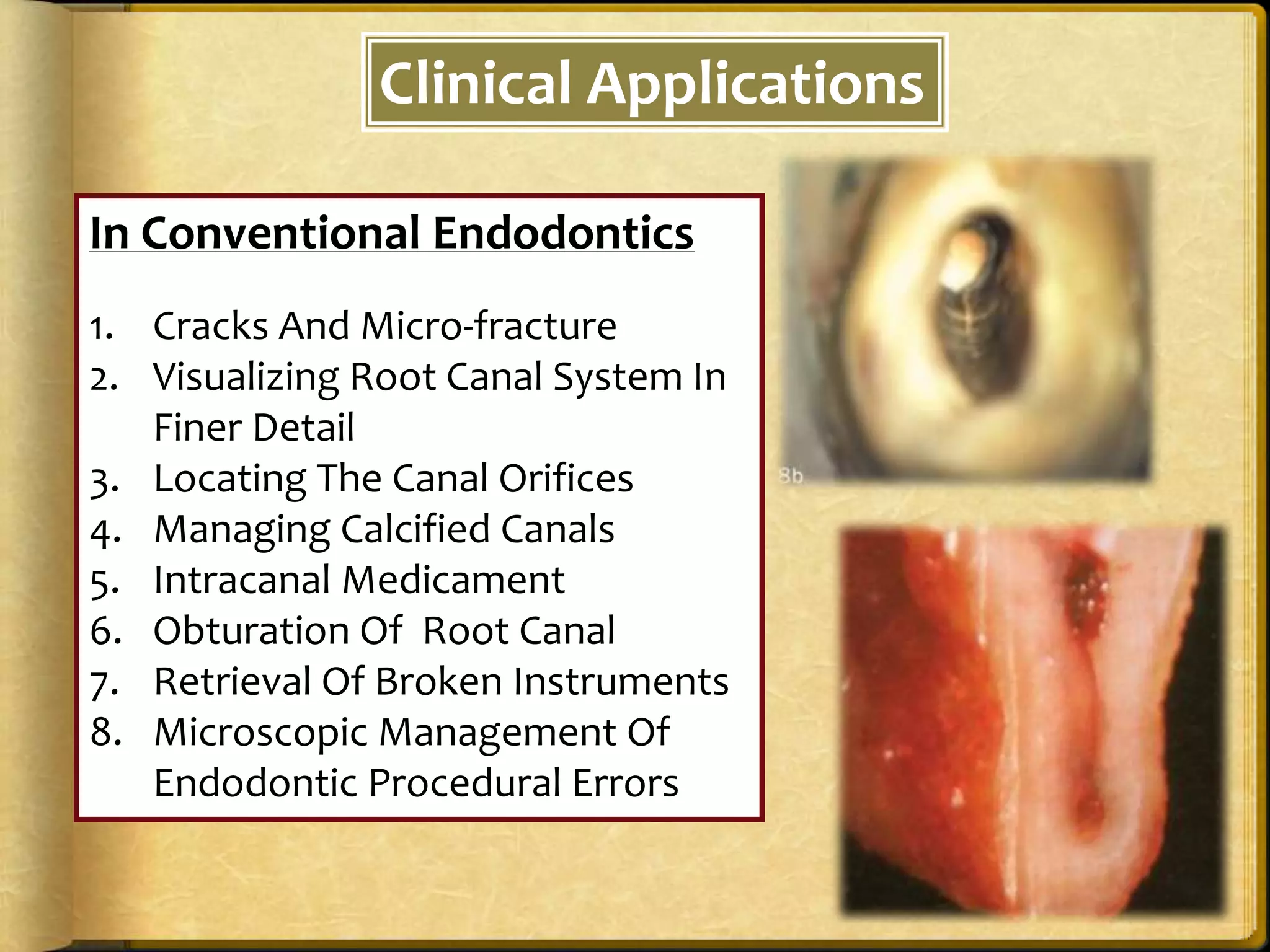 Clinical Applications
In Conventional Endodontics
1. Cracks And Micro-fracture
2. Visualizing Root Canal System In
Finer Detail
3. Locating The Canal Orifices
4. Managing Calcified Canals
5. Intracanal Medicament
6. Obturation Of Root Canal
7. Retrieval Of Broken Instruments
8. Microscopic Management Of
Endodontic Procedural Errors
 
