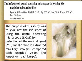 The purpose of this study was
to evaluate the influence of
using the dental operating
microscope (DOM) for
detection of the mesio-lingual
(ML) canal orifice in extracted
maxillary molars compared
with unaided vision (no
loupes or head- lamps).
 