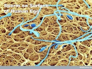 Sperm on Surface
of Human Egg
 