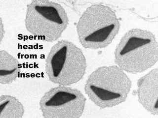 Sperm
heads
from a
stick
insect
 