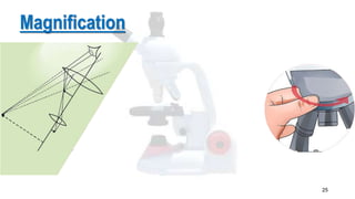 25
Magnification
 
