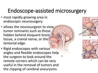 Endoscope-assisted microsurgery
• most rapidly growing area in
endoscopic neurosurgery.
• allows the neurosurgeon to view
tumor remnants such as those
hidden behind eloquent brain
tissue, a cranial nerve, or the
tentorial edge.
• Rigid endoscopes with various
angles and flexible endoscopes help
the surgeon to look around the
remote corners which can be very
useful in the removal of tumors and
the clipping of cerebral aneurysms.
 