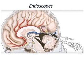 Endoscopes
 