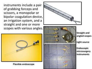 instruments include a pair
of grabbing forceps and
scissors, a monopolar or
bipolar coagulation device,
an irrigation system, and a
straight and one or more
scopes with various angles.
Straight and
angled scopes
Light source
Endoscopic
microsurgery
instruments
Flexible endoscope
 
